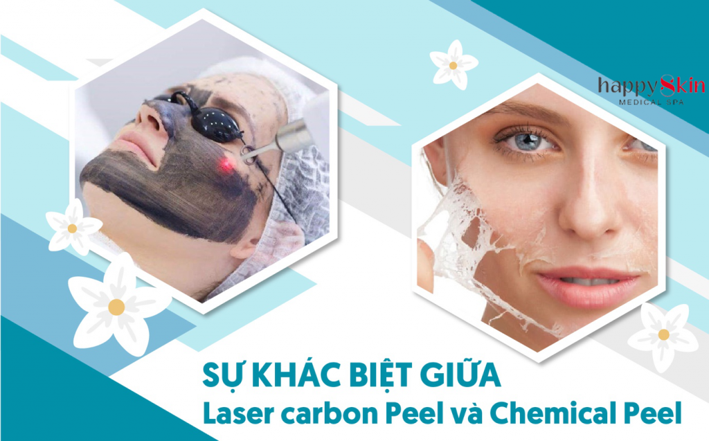 Sự khác biệt giữa carbon peel laser và chemical peel